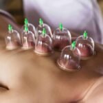 دورات حجامة معتمدة في مصر