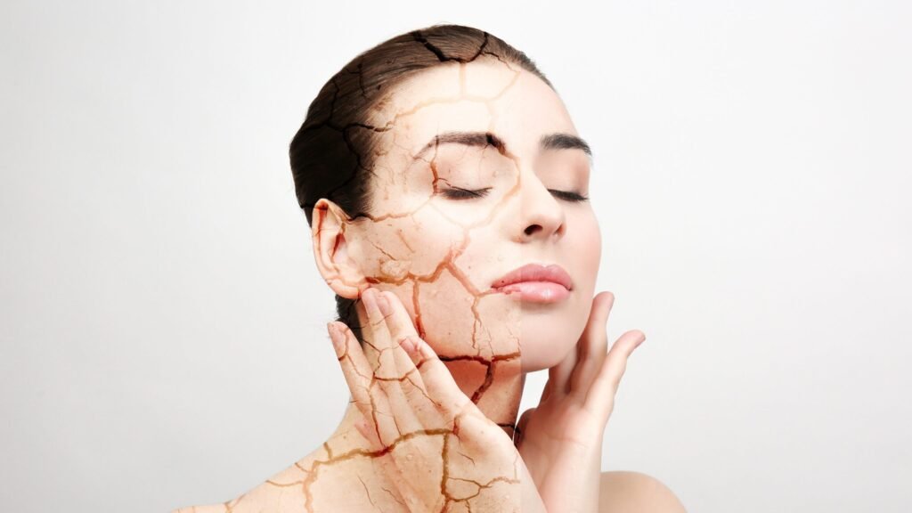 جفاف البشرة | دبلومة Skin Care بخصم 50%