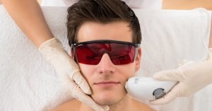 إزالة الشعر بالليزر