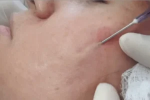 ورشة عمل تقطيع الألياف